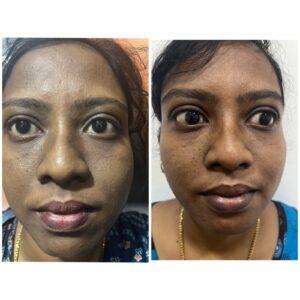 WhatsApp Image 2024-12-01 at 5.37.44 PM (1)