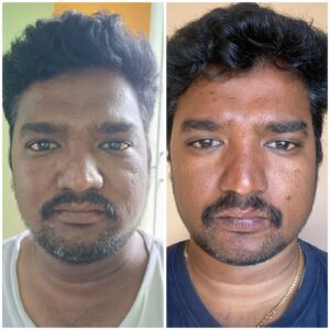 WhatsApp Image 2024-12-01 at 5.37.44 PM